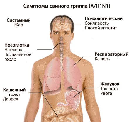 Симптомы свиного гриппа у человека 2016