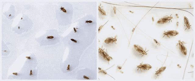Как избавится от насекомых из волосы